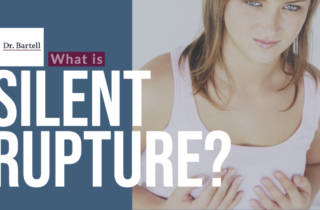 silent implant rupture